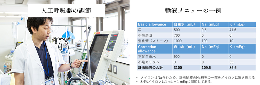 人口呼吸器の調節・輸血メニューの一例